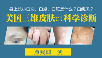 脸部突然出现一块白斑